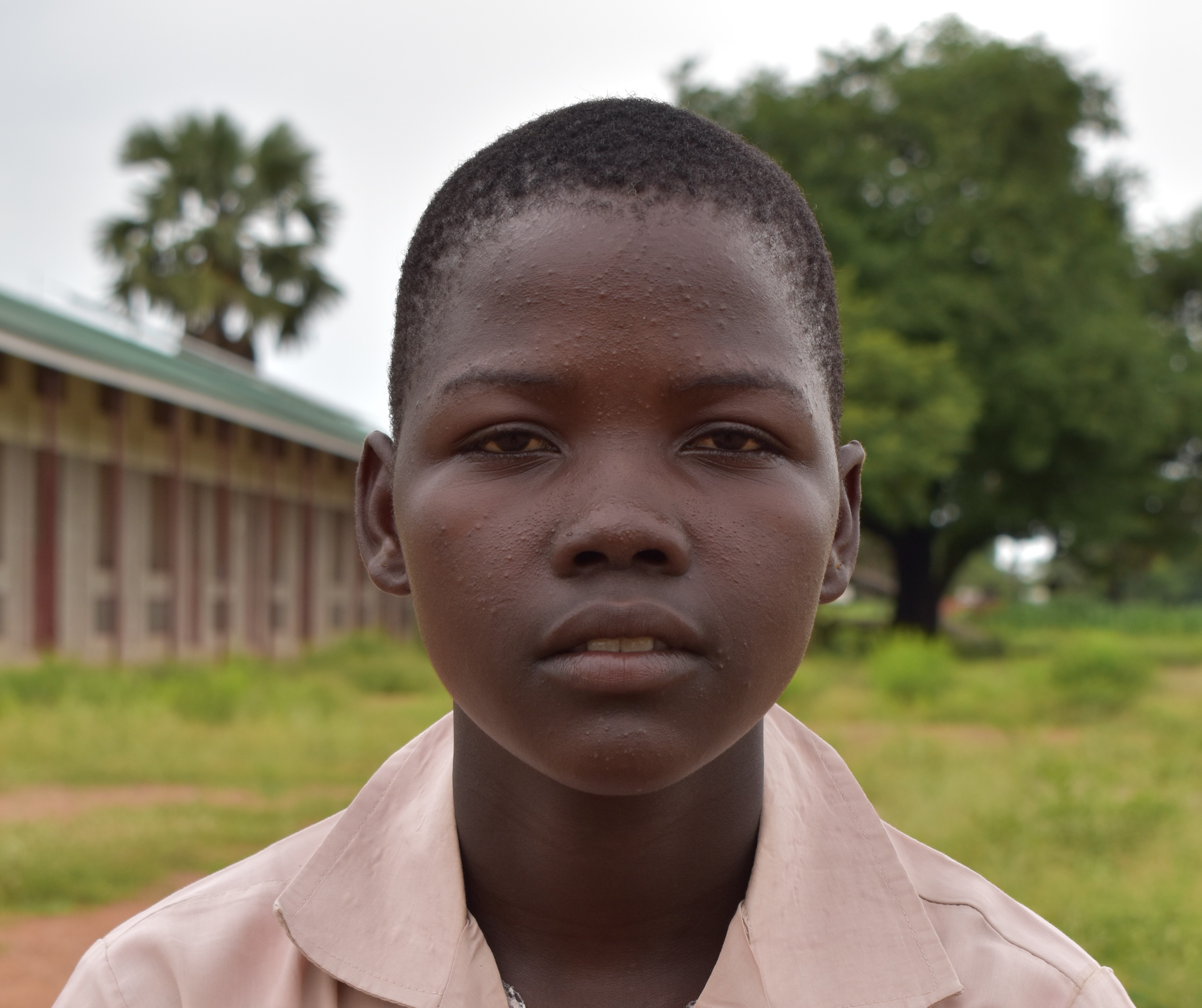 Die 16-jährige Martha Akol Kedit ist glücklich, denn sie darf die Loreto-Schule in Maker Kuei besuchen und erhält die Chance auf Bildung. Vielen Mädchen bleibt das aufgrund einer frühen Heirat verwehrt.