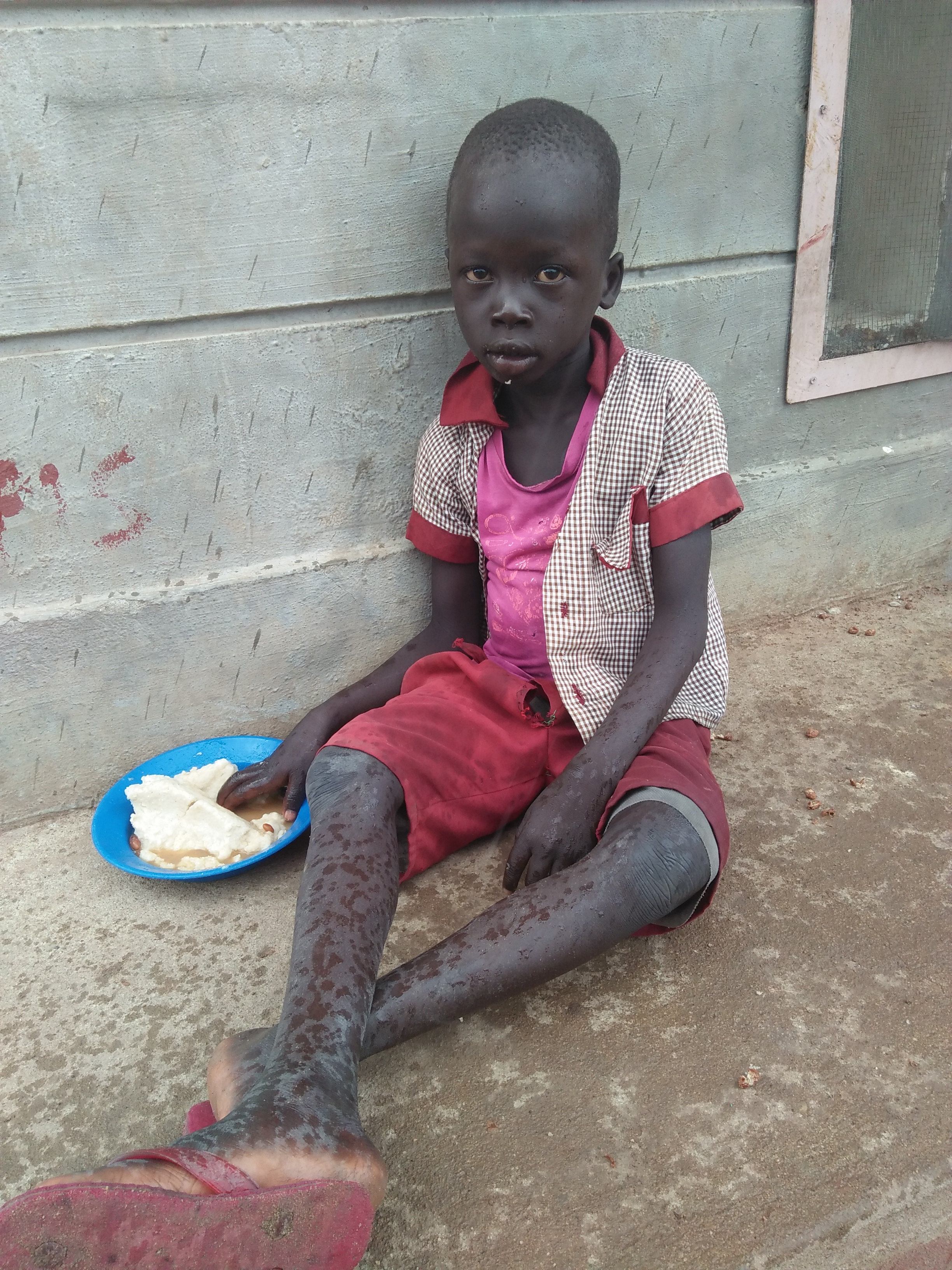 Besonders wichtig neben dem Unterricht sind die Mahlzeiten, die die Schüler erhalten. Reis, Maisbrei oder Bohnen stehen auf dem Speiseplan und geben Energie zum Lernen. Ihre Spende stillt den (Wissens-)Hunger der Mädchen und Jungen!