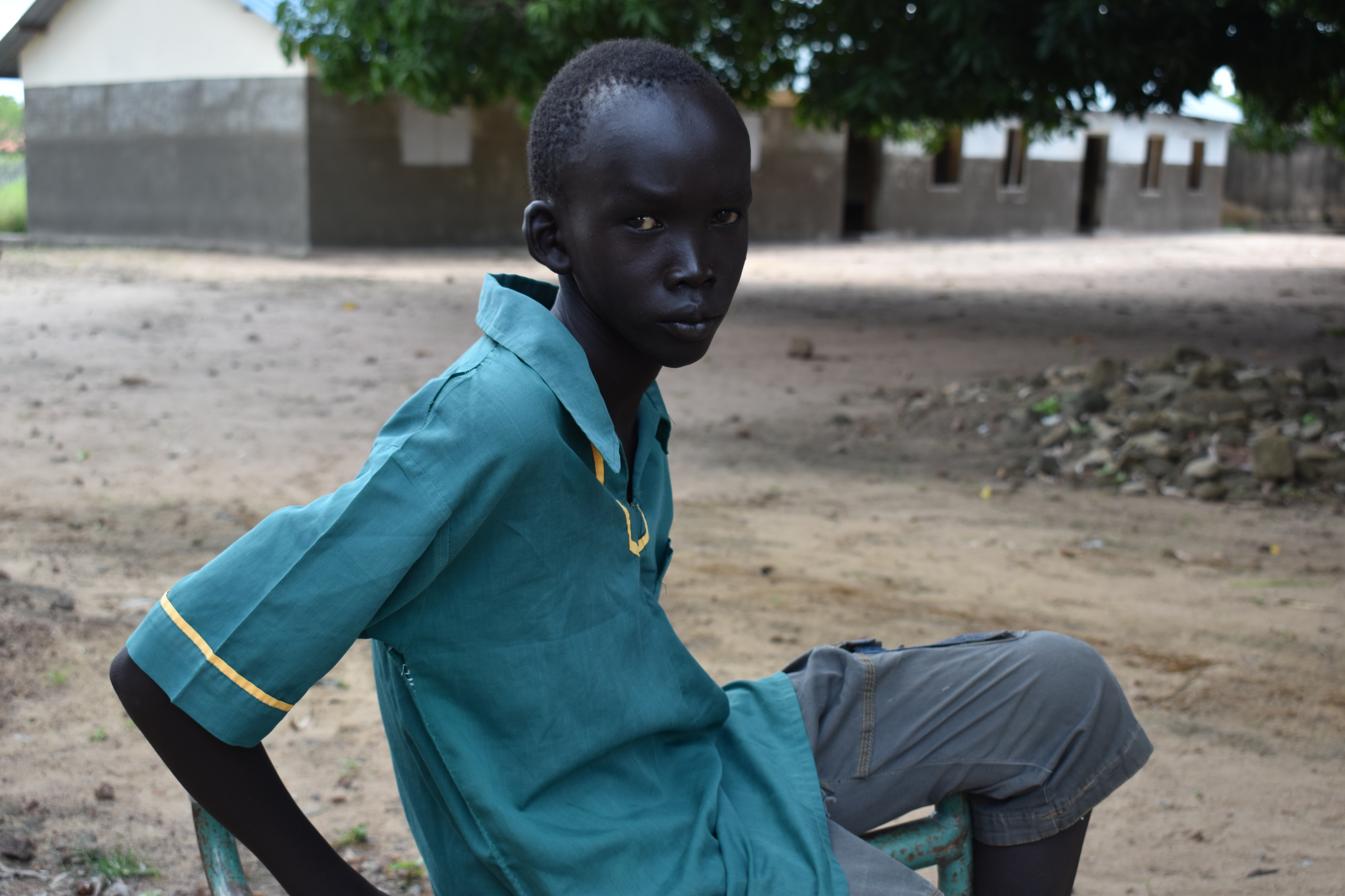 Madeng Makhoi leidet oft Hunger, weil seine Mutter wegen der Corona-Pandemie ihr Einkommen verloren hat. Madeng Makhoi leidet oft Hunger, weil seine Mutter wegen der Corona- Pandemie ihr Einkommen verloren hat.