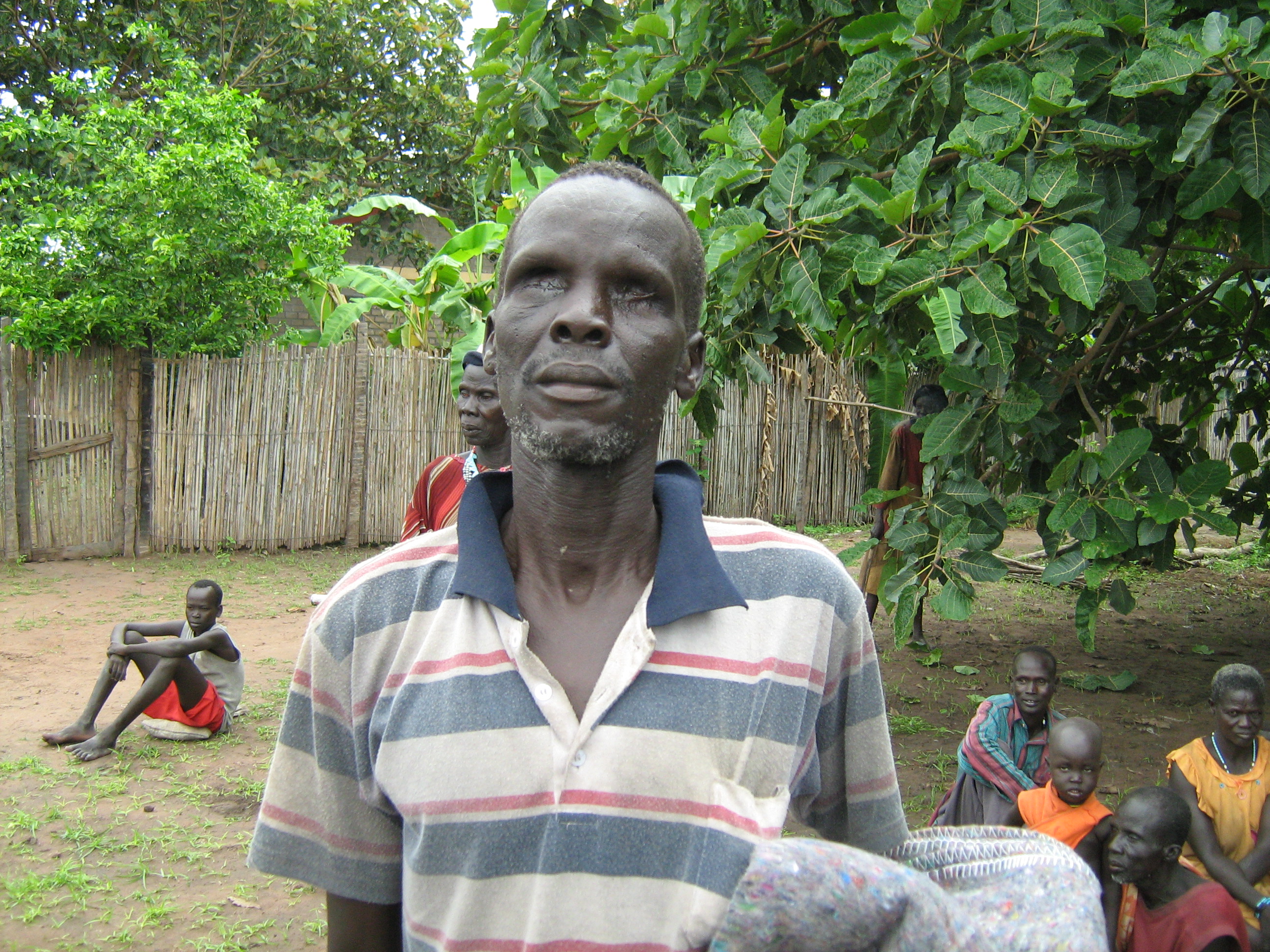 Die Menschen im Dorf der Leprakranken und Blinden brauchen unsere Hilfe. Viele tragen die schwere Last der Verantwortung für ihre Familien.