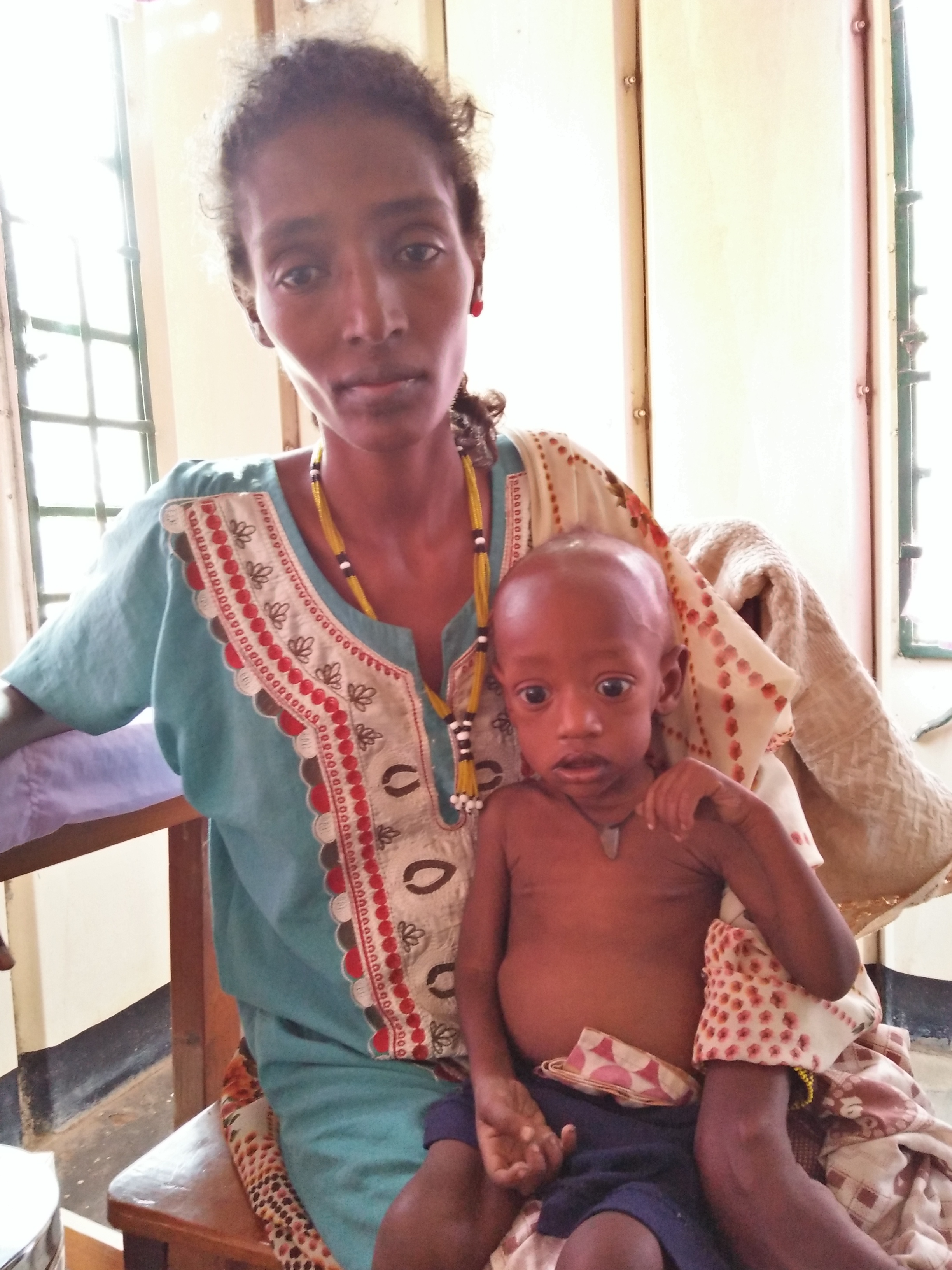 Aguek Mamer ist zwei Tage lang mit ihrem kleinen Sohn Bol (1) unter großen Gefahren zur Klinik in Rumbek gelaufen, um hier Hilfe zu finden. Beide sind mangelernährt.