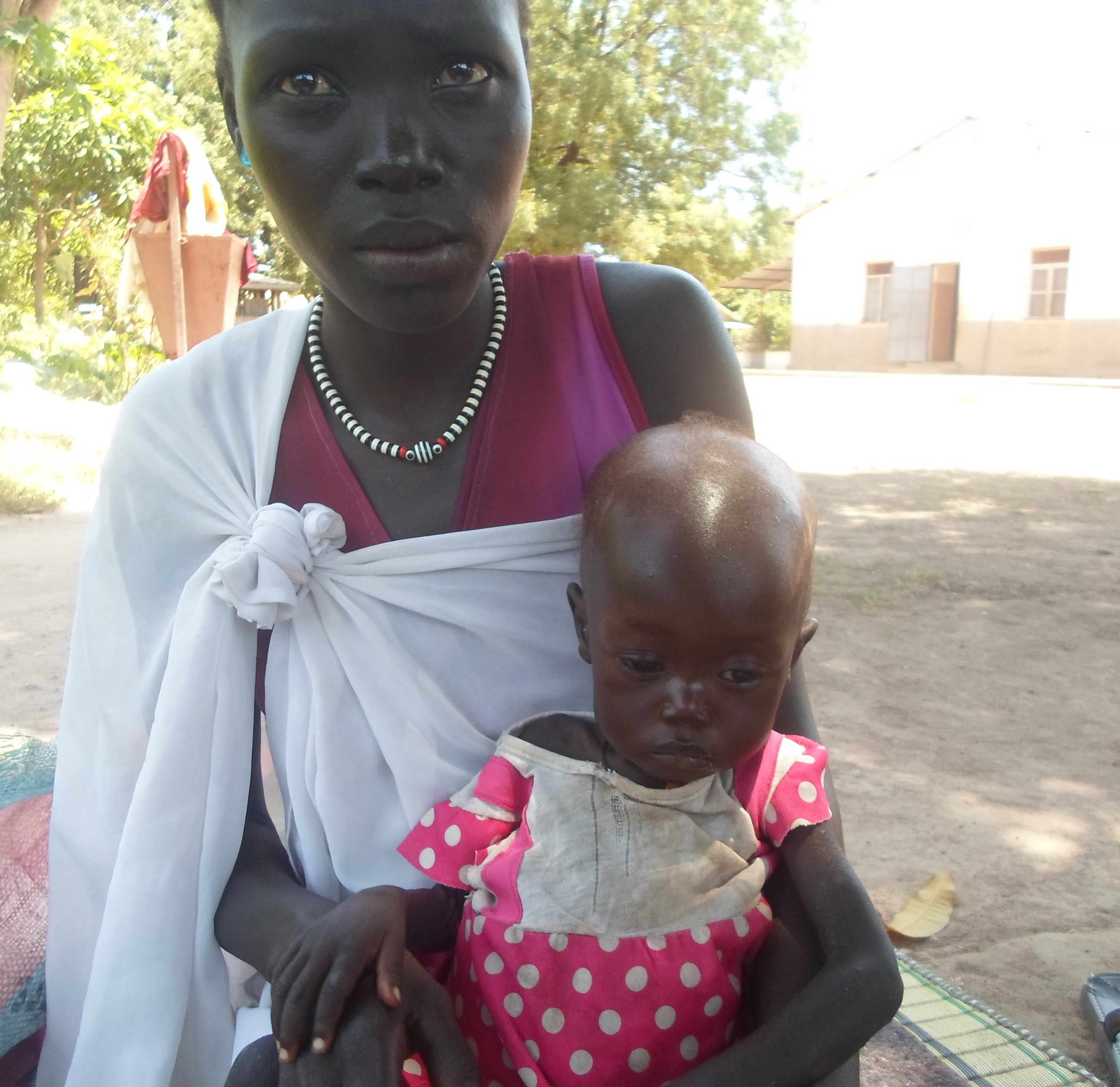 Daher ist das Essen in Akoldes Familie knapp. Auch Mary, die Mutter der Kleinen, leidet unter dem Hunger und hatte nie genug Milch, um ihr jüngstes Kind zu stillen, sodass das Mädchen nun dringend Hilfe bedarf.