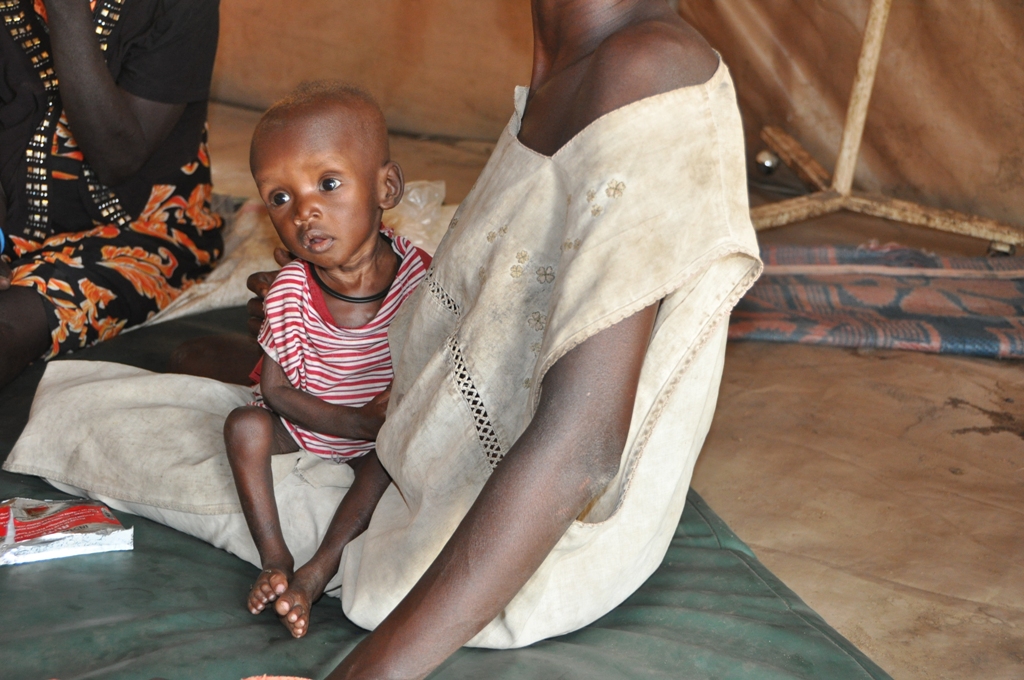 Gatjang ist 10 Monate alt und mangelernährt.