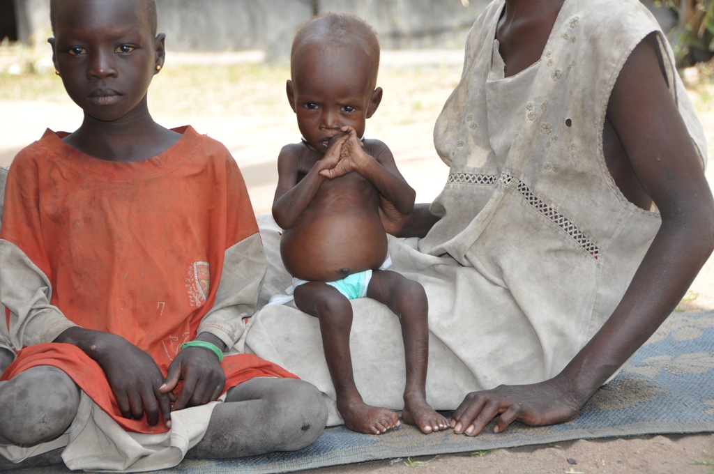 Mit Hilfe von Spezialnahrung und Medizin stehen die Chancen gut, dass es Gatjang bald besser geht.