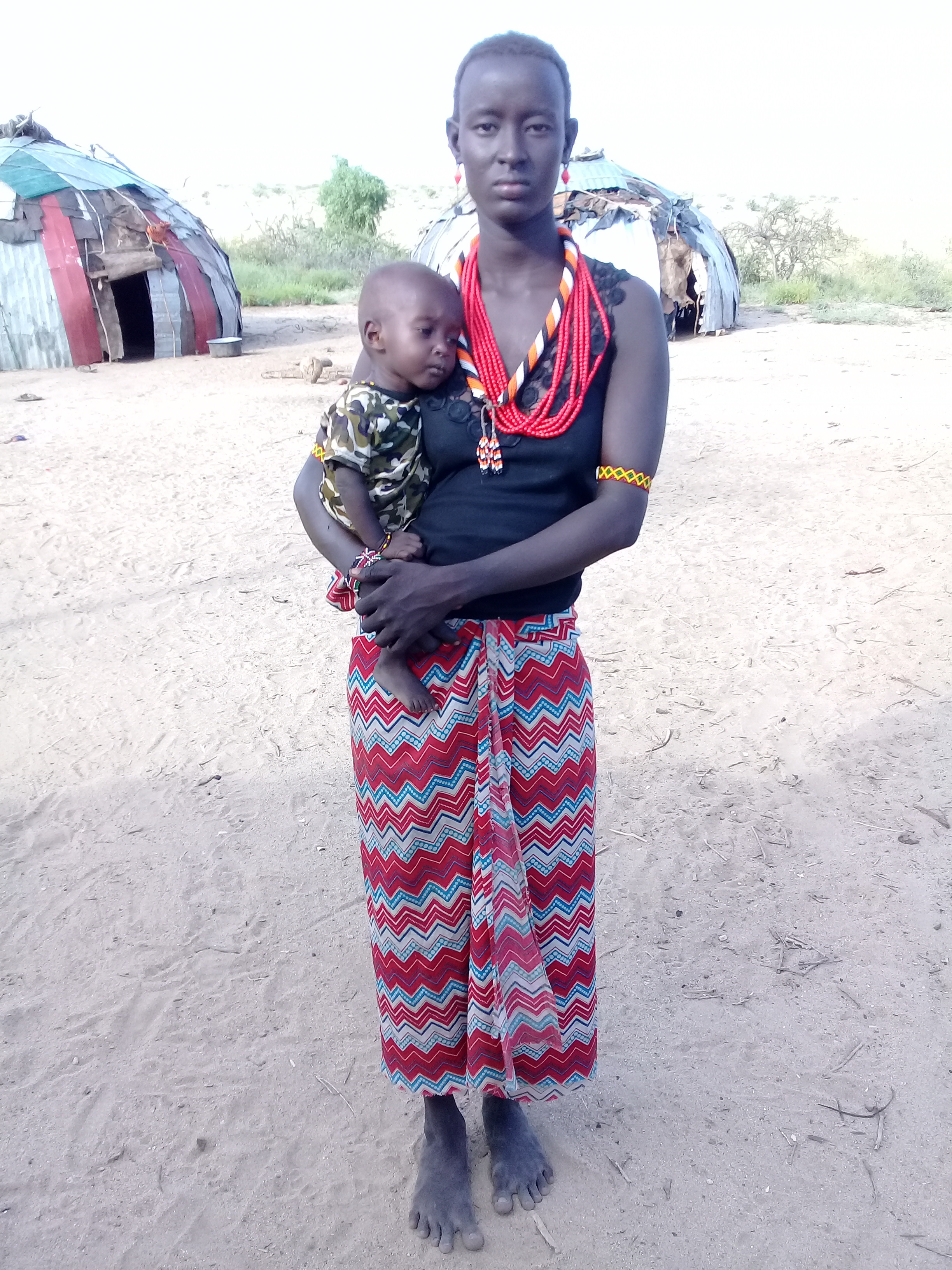 Akarkar Lomalinga’a macht sich Sorgen um ihren Sohn David. Er ist wie viele Kinder im kenianischen Illeret kraftlos und zu dünn.