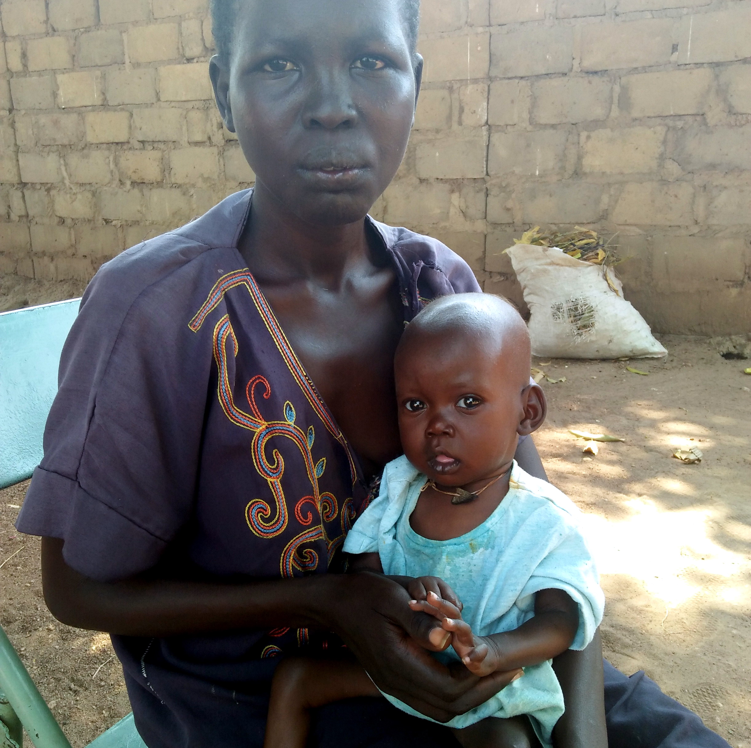 Nach drei Wochen intensiver Behandlung hat Akol Fortschritte gemacht. Durch die Spezialnahrung beginnt der Körper des Kindes sich zu erholen.