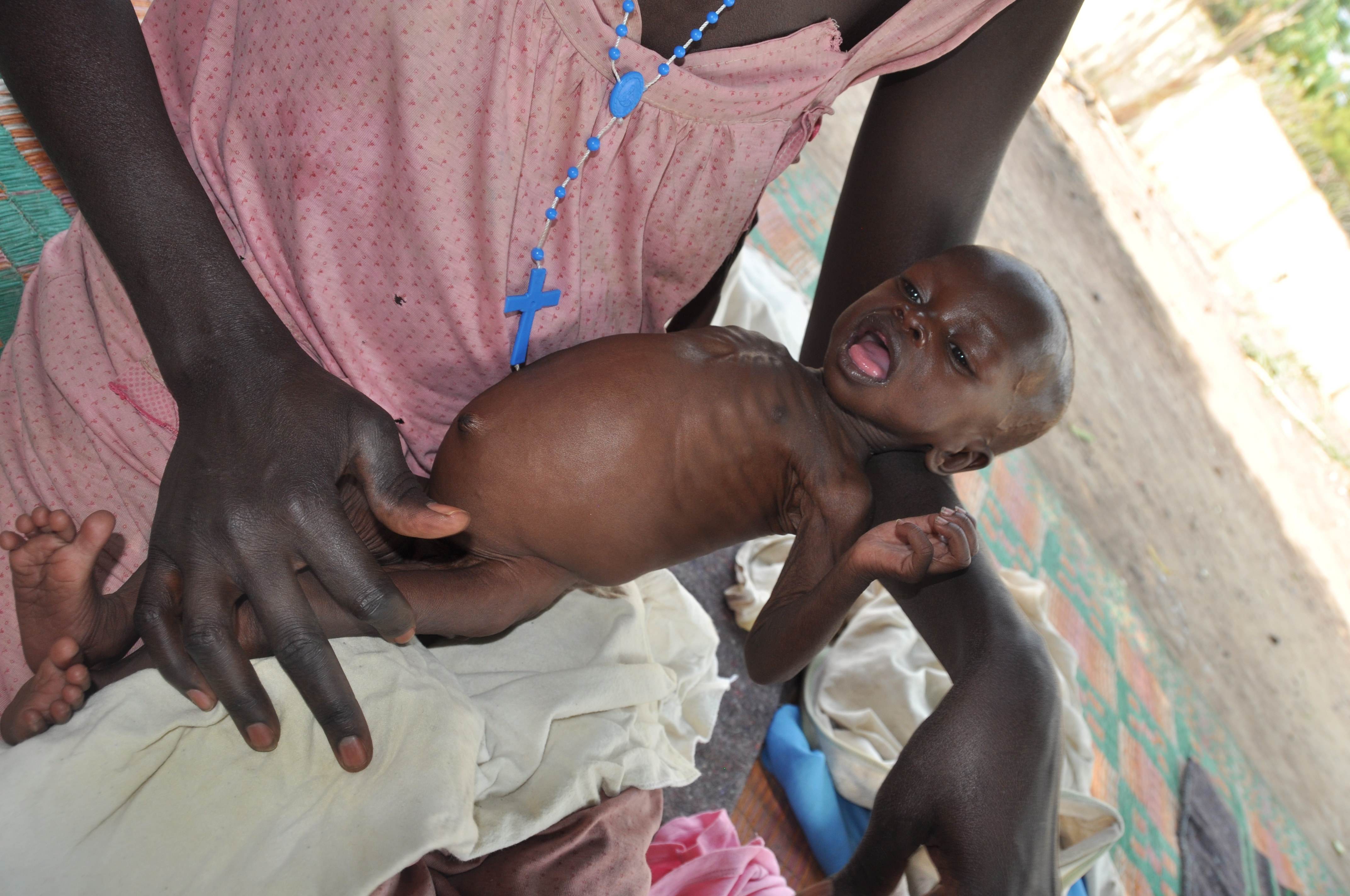 Mit Hochenergiekeksen wird die kleine Panda im Ernährungszentrum von Rumbek wieder aufgepäppelt. Unsere Unterstützung ist den Menschen im Südsudan ein großer Segen.