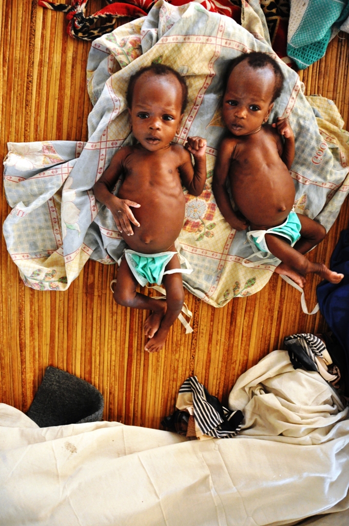 Nun sind Nyakume und ihre Zwillingsschwester Nyachiok gewachsen und nehmen aufmerksam ihre Umgebung wahr. Sie stehen der Entwicklung gesunder Kinder noch nach, doch ihr Zustand hat sich deutlich verbessert.