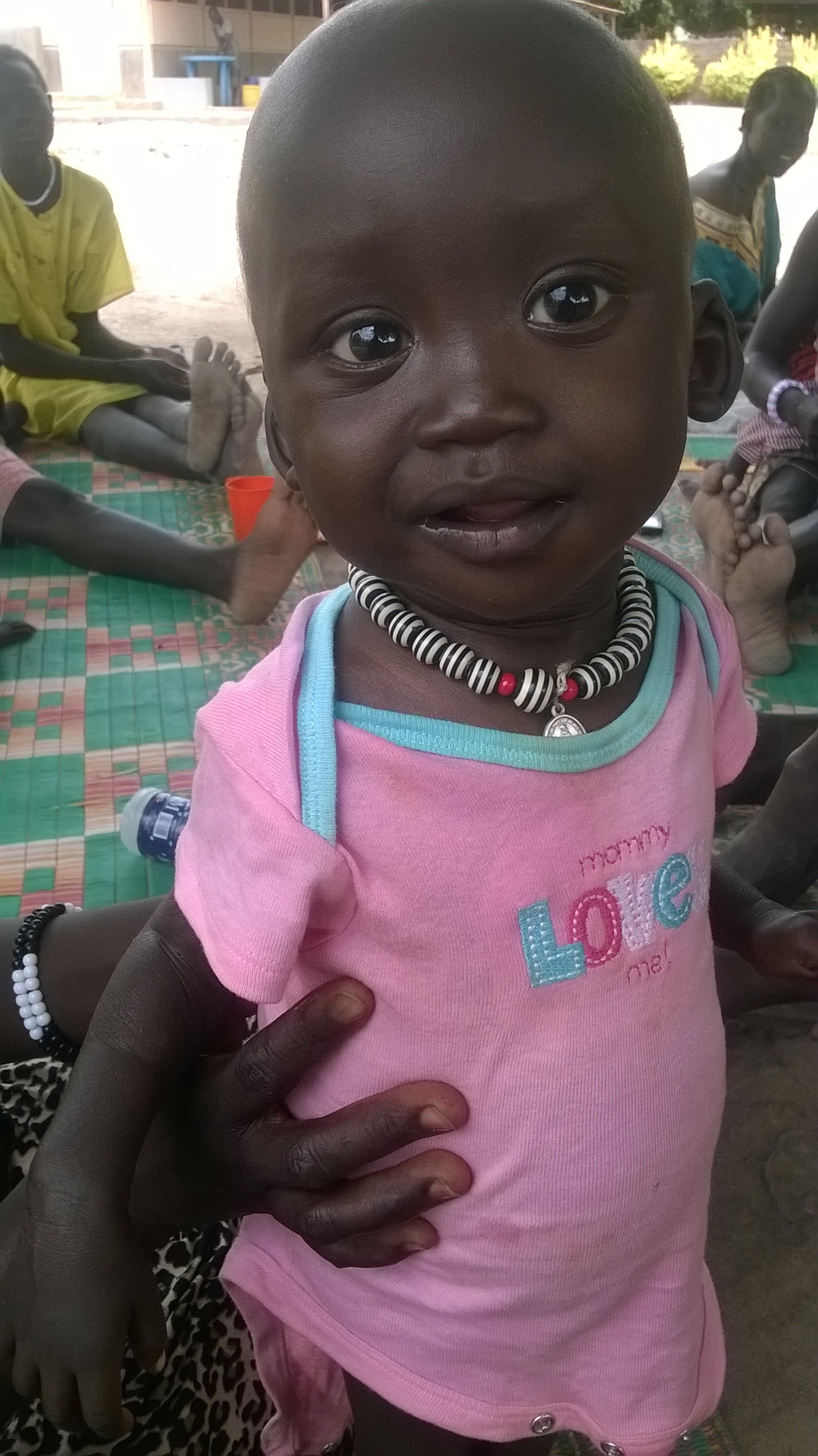 Sieben Wochen später ist Meen dank der Behandlung mit geeigneter Medizin und Spezialnahrung auf dem Weg der Besserung. Seine Haut heilt, und er nimmt stetig zu.