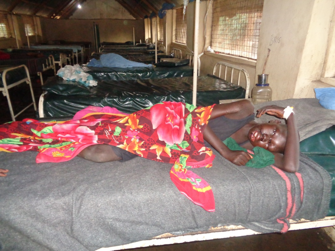 Vor Hunger und Erkrankung bewahren die Behausungen nicht: Dieses Mädchen ist im Gesicht von Krankheit gezeichnet, doch in der Buschklinik kann ihr geholfen werden.