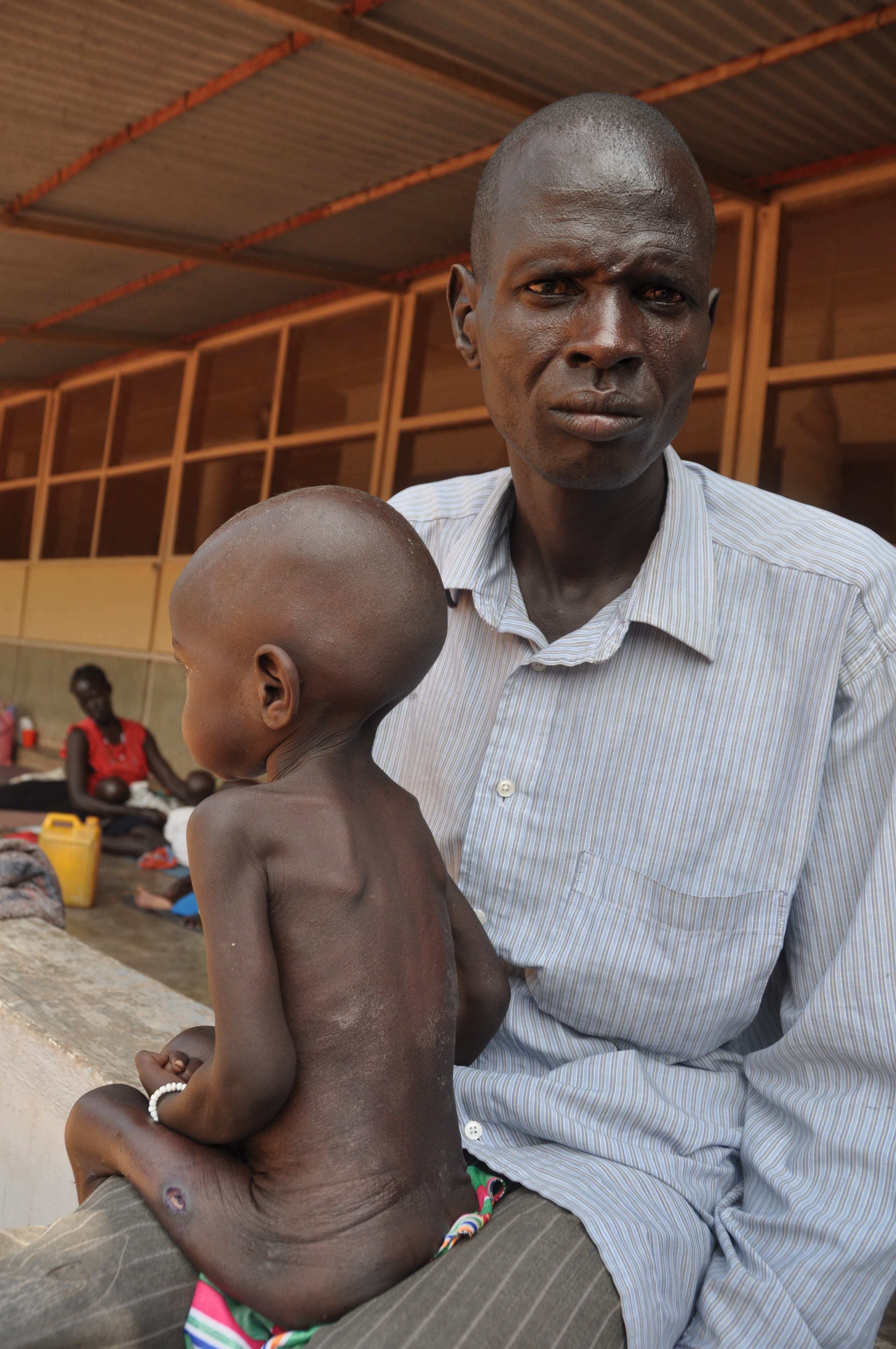 Die eineinhalbjährige Adong Mawal Bol ist stark unterernährt, ihr ganzer Körper ist mit entzündeten Wunden übersät.