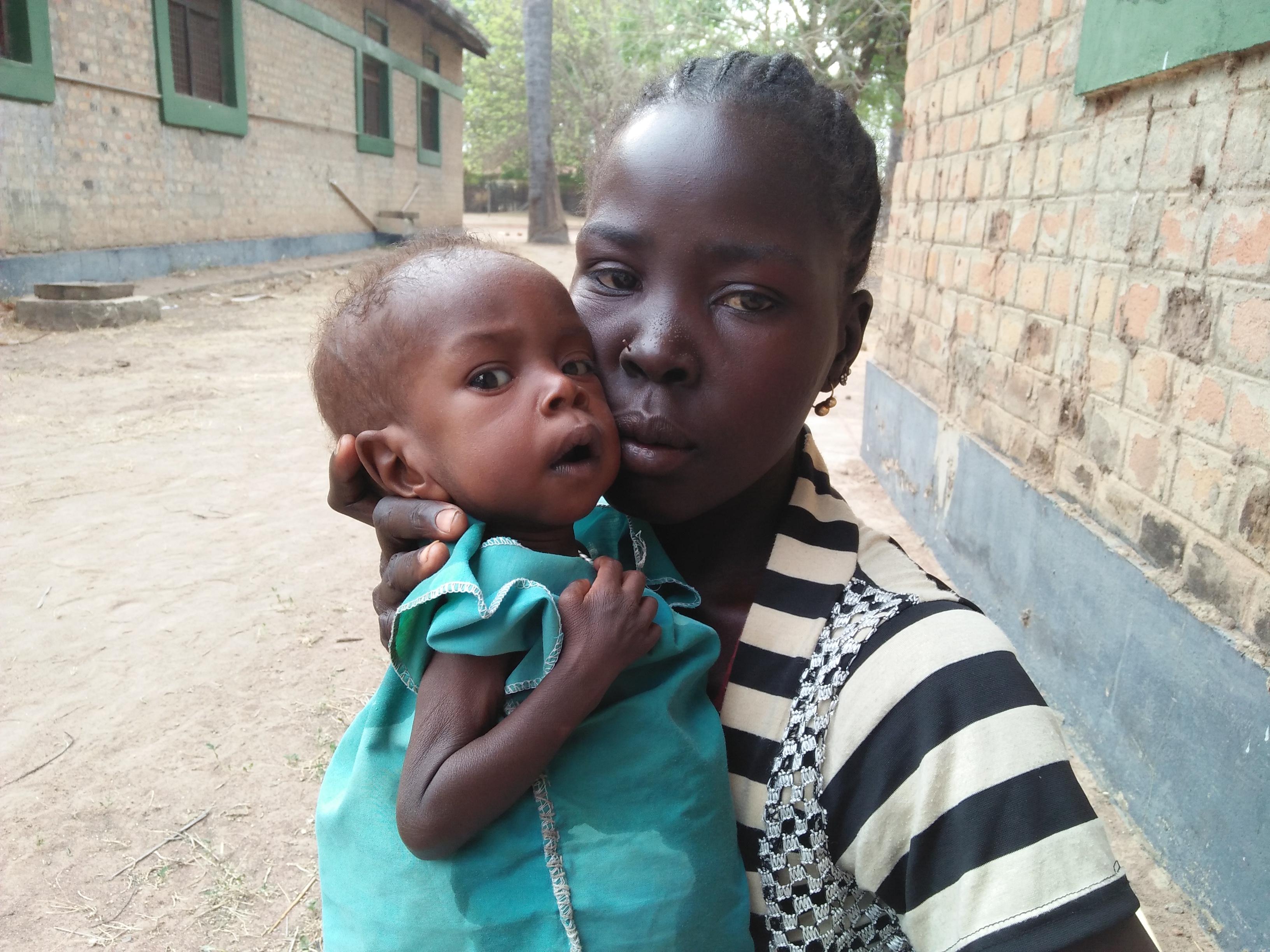 Manyang Malual ist zu schwach, um sich aufrecht zu halten oder gar alleine zu stehen. Seine Mutter hat mit ihrem kranken Jungen die Klinik in Rumbek aufgesucht.