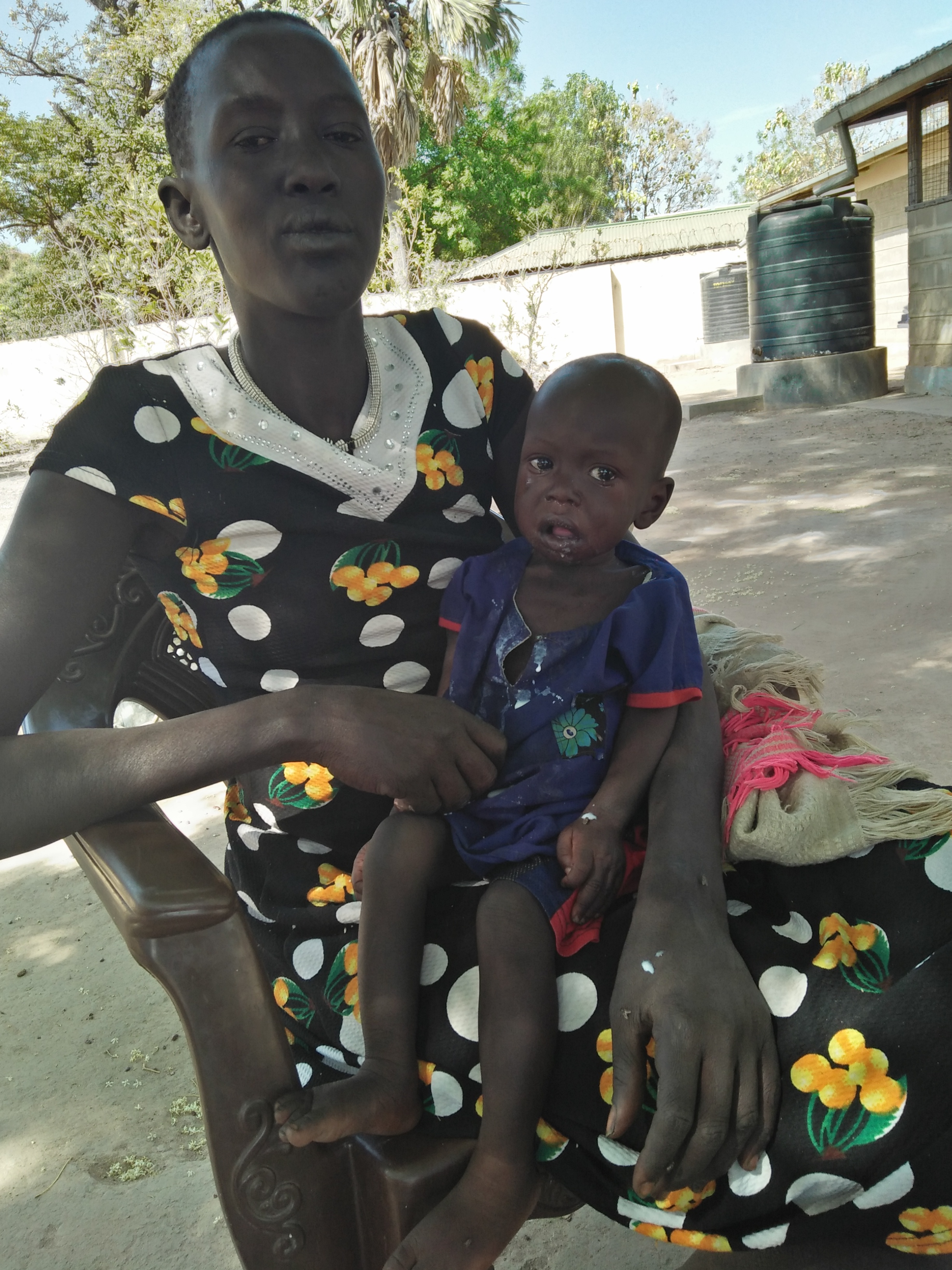 Der neun Monate alte Mathiang ist schon länger krank. Er leidet unter schwerer Mangelernährung, Fieber und Durchfall, und sein kleiner Körper ist ganz geschwächt davon.