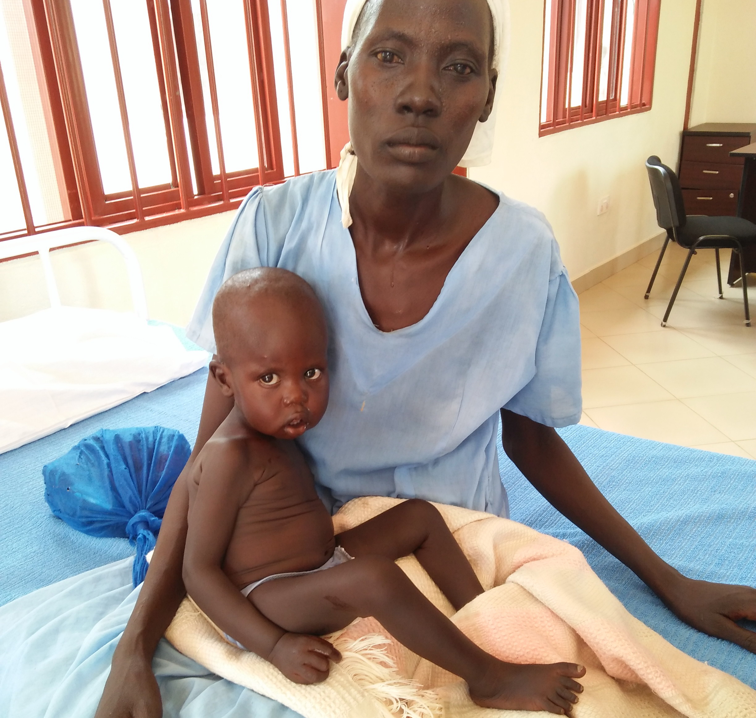 Der einjährige Madier Gum ist mangelernährt – im Ernährungsprogramm der Klinik wird er ambulant behandelt. Medikamente und Nahrung werden der Familie zur Verfügung gestellt.