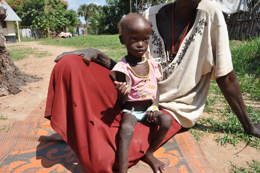 Nyabuor ist sehr dünn, ihre Haare bleichen aus, und aufgrund einer Lungenentzündung ist sie sehr kurzatmig. In unserer Klinik in Nyal kann ihr geholfen werden.
