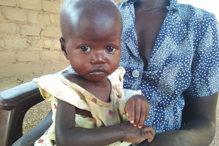 Amer Mayom ist bedrohlich krank und unterernährt. Armut und Hunger zehren  an den Kräften des kleinen Mädchens. Lebensrettende Hilfe erhält das Kind in der Krankenstation der Diözese Rumbek.
