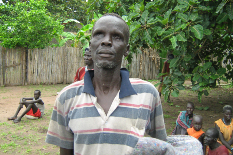 Die Menschen im Dorf der Leprakranken und Blinden brauchen unsere Hilfe. Viele tragen die schwere Last der Verantwortung für ihre Familien.