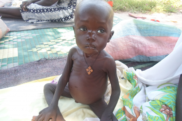 Akolde Mading ist zwei Jahre alt und schwer mangelernährt. Ihre Familie leidet sehr unter den Konflikten im Südsudan. Eine geregelte Feld- und Viehwirtschaft war ihnen unmöglich.