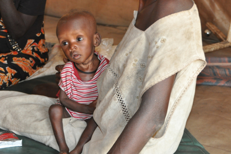 Gatjang ist 10 Monate alt und mangelernährt.