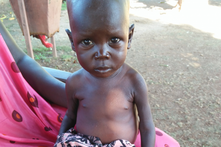 Das 18 Monate alte Mädchen braucht neben Medikamenten gegen ihre Malaria-Infektion dringend Spezialnahrung. Mit Ihrer Unterstützung kann Kindern wie Saba geholfen werden!