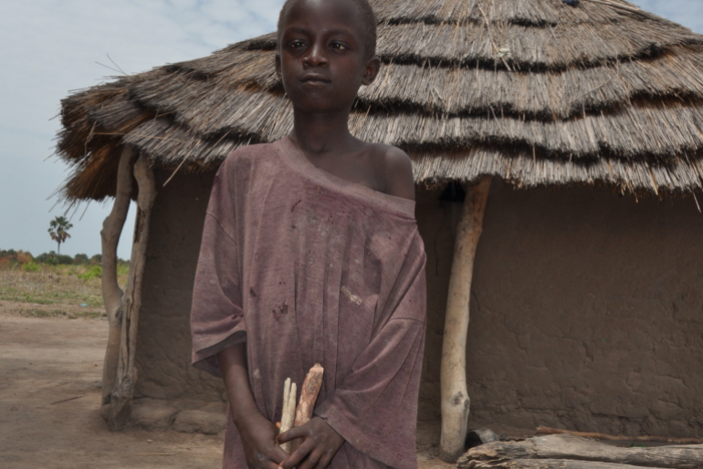 Besonders Kinder sind häufig von Mangelernährung betroffen, so wie Sarahs Sohn Mark Deng. Mit Spezialnahrung kann ihnen geholfen werden.