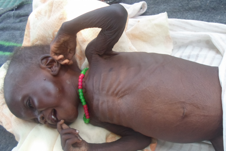 Monydeng ist bei seiner Erstuntersuchung so schwach, dass er nicht alleine sitzen kann. Sein Körper ist erschreckend ausgemergelt.