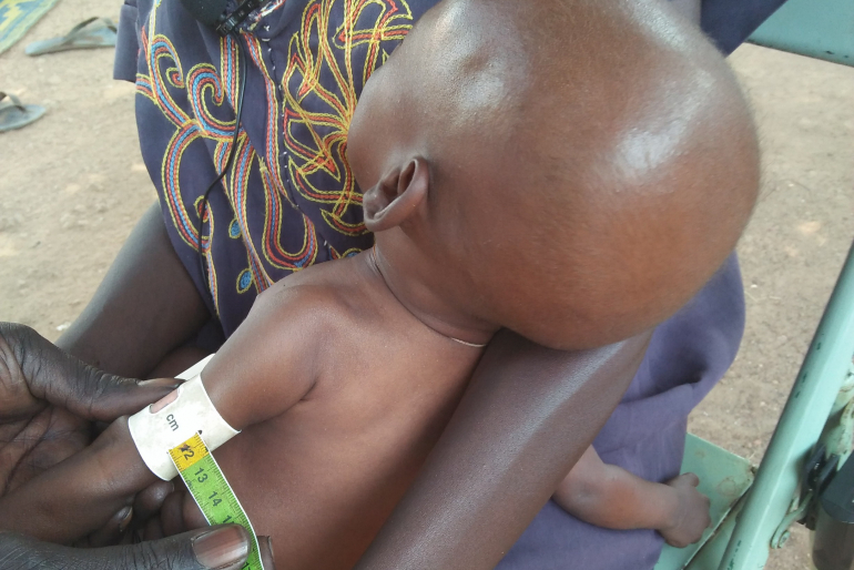Das MUAC-Band, das am Oberarm eines Kleinkindes angelegt wird, zeigt einen Wert im roten Bereich – Akol ist extrem mangelernährt und in großer Gefahr.