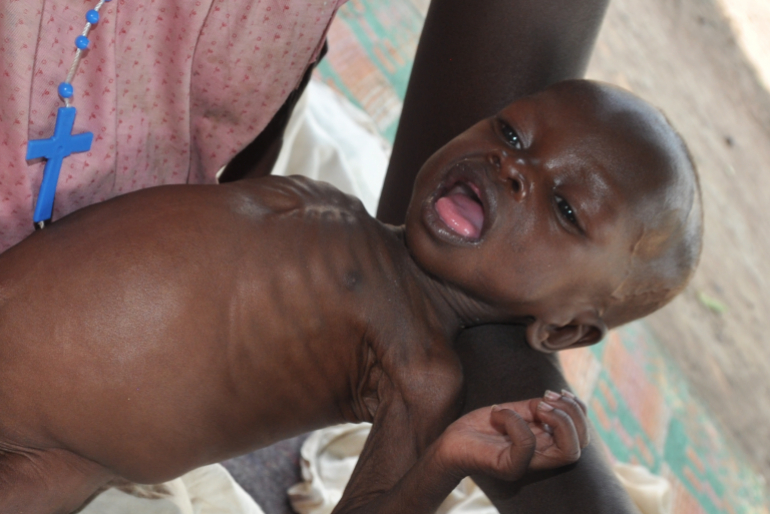 Mit Hochenergiekeksen wird die kleine Panda im Ernährungszentrum von Rumbek wieder aufgepäppelt. Unsere Unterstützung ist den Menschen im Südsudan ein großer Segen.