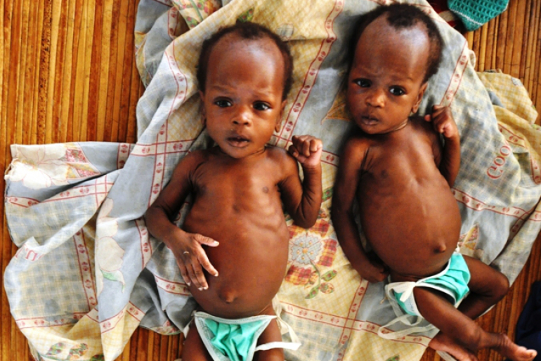 Nun sind Nyakume und ihre Zwillingsschwester Nyachiok gewachsen und nehmen aufmerksam ihre Umgebung wahr. Sie stehen der Entwicklung gesunder Kinder noch nach, doch ihr Zustand hat sich deutlich verbessert.