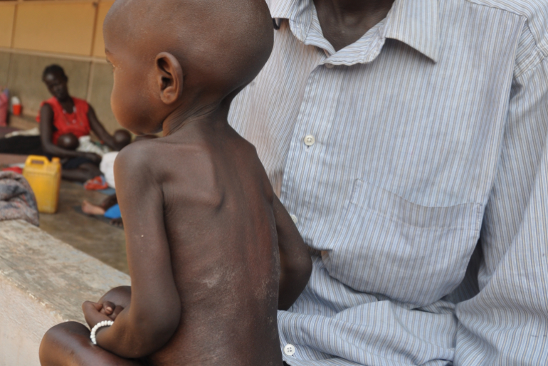 Die eineinhalbjährige Adong Mawal Bol ist stark unterernährt, ihr ganzer Körper ist mit entzündeten Wunden übersät.