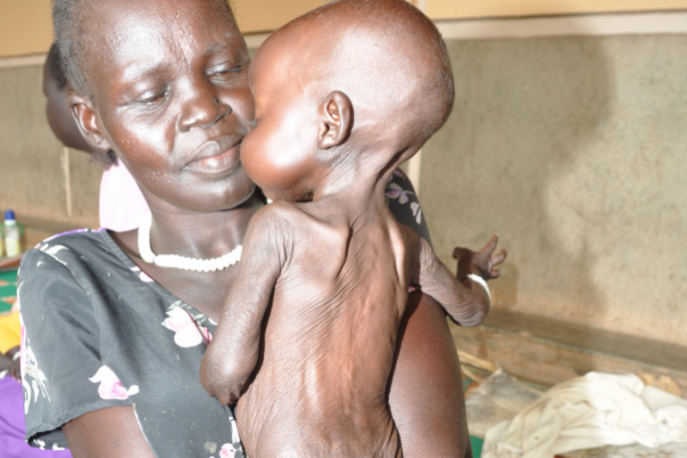 Ihre Haut ist schlaff und faltig, aber mit der richtigen Behandlung kann das Mädchen gesund werden. Dafür brauchen wir Ihre Hilfe – danke für jede Gabe!