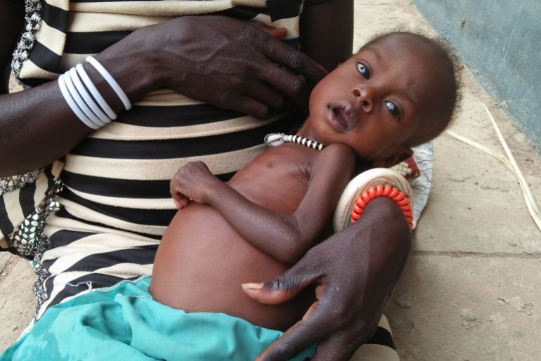An dem aufgeblähten Bauch ist die Mangelernährung des Einjährigen deutlich zu erkennen; der übrige Körper ist viel zu dünn.