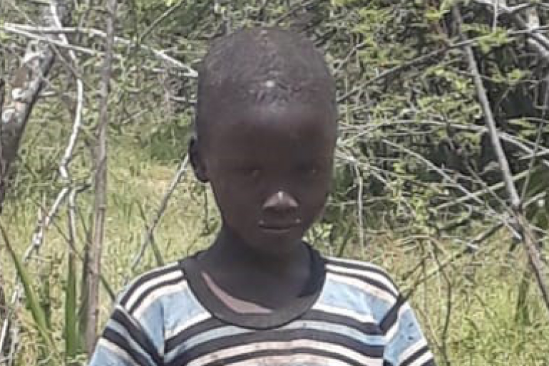 Der aufgedunsene Bauch, verursacht von Wassereinlagerungen und einer vergrößerten Leber, ist meist ein Anzeichen für Mangelernährung.