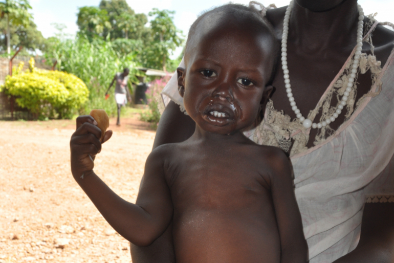 Die Mediziner haben Malongs Zustand stabilisiert. Doch der Junge muss noch weitere Wochen aufgepäppelt werden. Viele Kinder im Südsudan erleiden solch ein Schicksal – gemeinsam können wir ihnen helfen.
