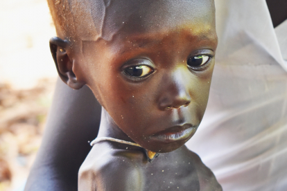 Der Hunger zehrt an den Kräften der mangelernährten Kinder in Rumbek/ Südsudan.
