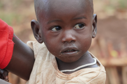 Teresa (2) leidet an Malaria und Durchfall. Zudem ist sie mangelernährt. Ihre  Familie erhält von uns Nahrungsmittelhilfe, um die akute Not zu mildern.