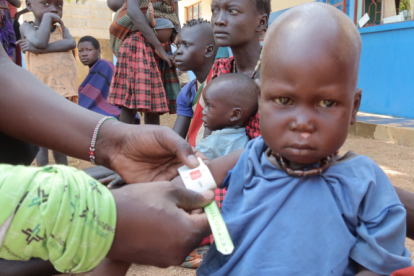 Vor allem die Kleinsten sind die Leitragenden in Hungerkrisen und kämpfen mit Unterernährung. 
