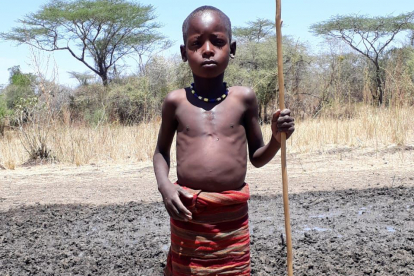 Ein aufgeblähter Bauch und Rippen, die sich unter der Haut abzeichnen – der sechsjährige John Lokwang ist wie viele Kinder im ugandischen Kosike mangelernährt.