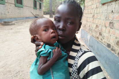 Manyang Malual ist zu schwach, um sich aufrecht zu halten oder gar alleine zu stehen. Seine Mutter hat mit ihrem kranken Jungen die Klinik in Rumbek aufgesucht.