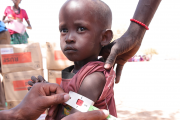 Mangelernährtes Kind in Kenia