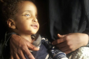 Kleinkinder sind im Jemen besonders geschwächt. Hoffnungszeichen sorgt dafür, dass unterernährte und kraftlose Kinder wie dieser Junge Spezialnahrung erhalten.