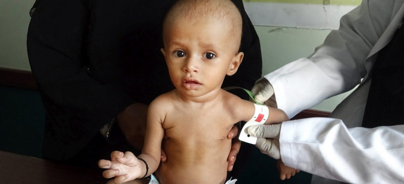 Hungerkrise im Jemen trifft die Kleinsten